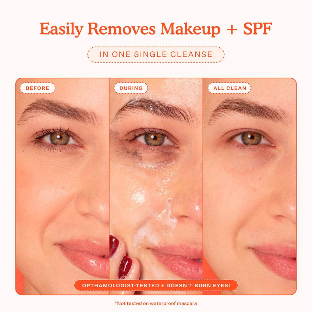SOS Gentle Hydrating Gel Cleanser + Makeup Remover -Tower 28